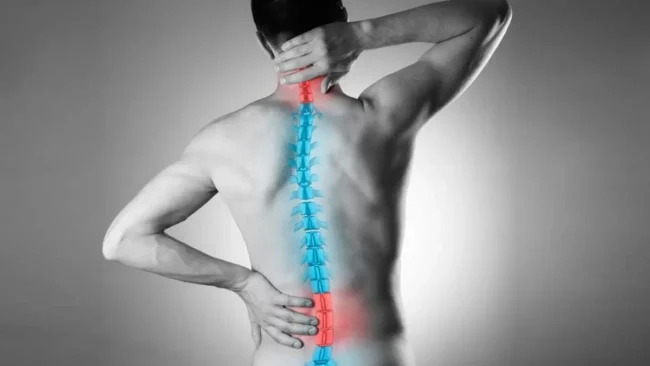 Spine fixation