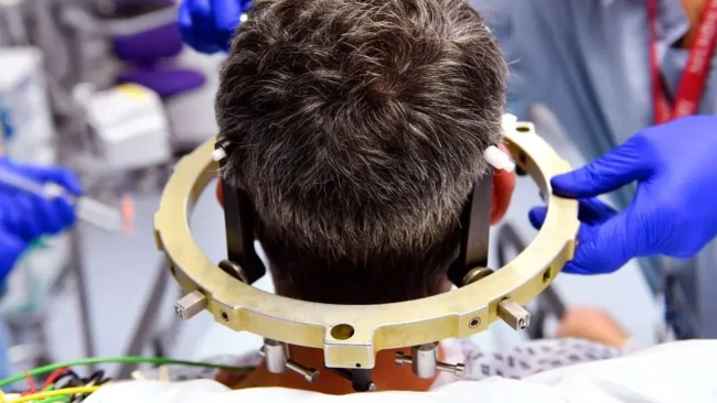 Stereotactic Brain Tumor Surgery